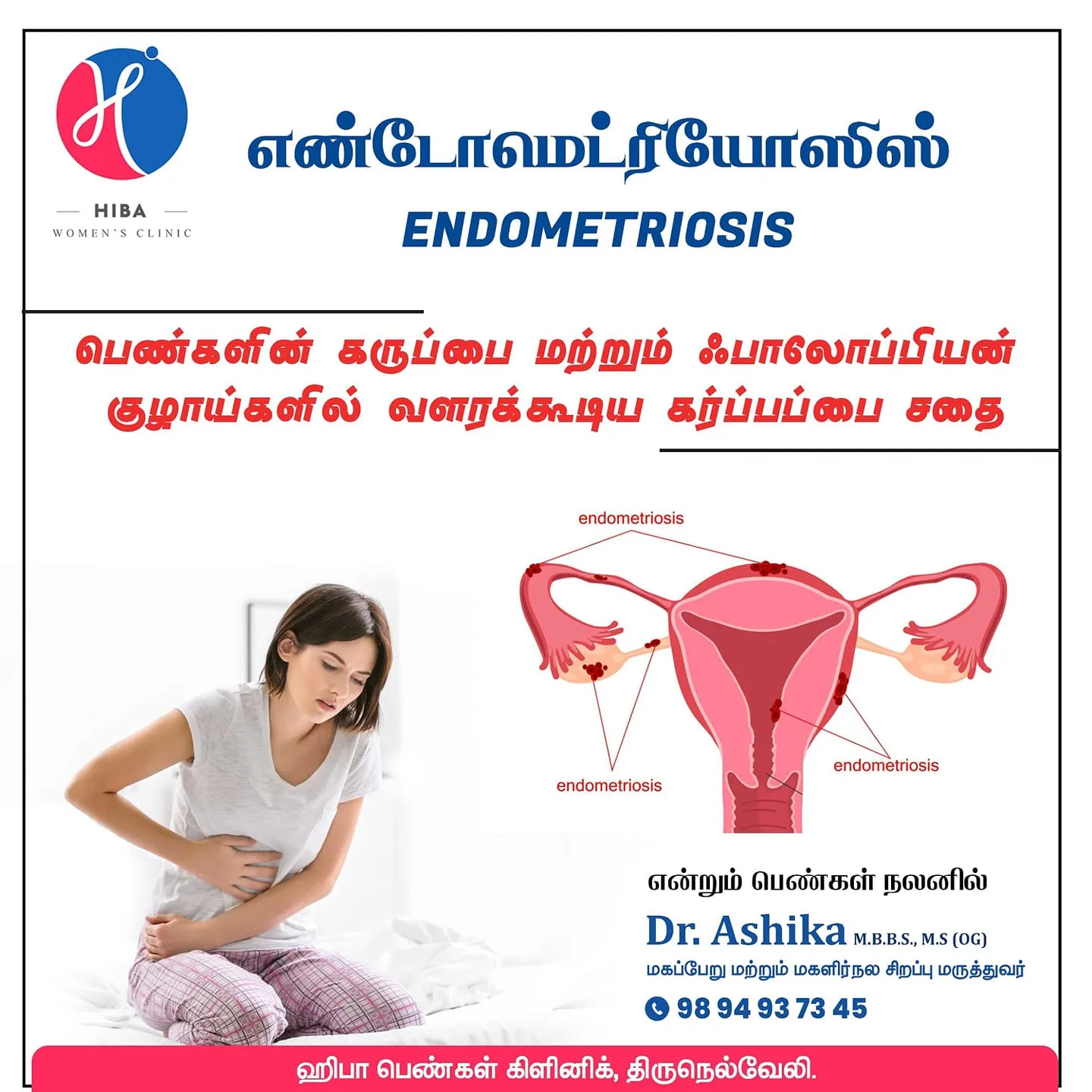 Endometriosis — symptoms, diagnosis and treatment