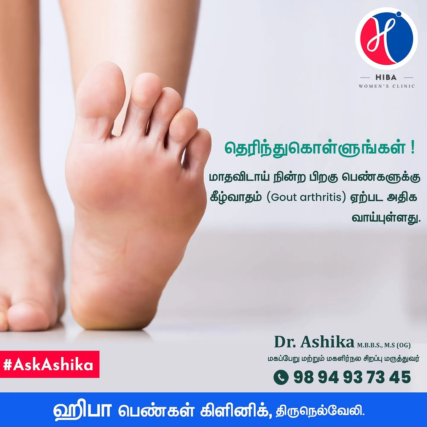 Gout and arthritis — symptoms and management