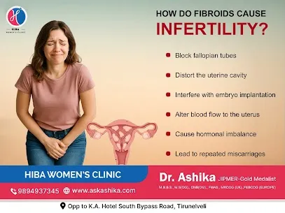 Can fibroids stop pregnancy? Guidance from a gynecologist in Tirunelveli
