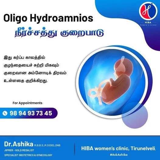 Oligohydramnios (low amniotic fluid) in pregnancy