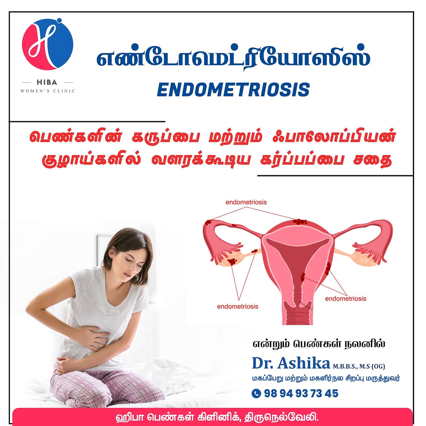 Endometriosis — symptoms, diagnosis and treatment
